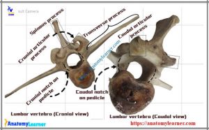 Animal Vertebrae Identification - Anatomy of Cervical, Thoracic and ...