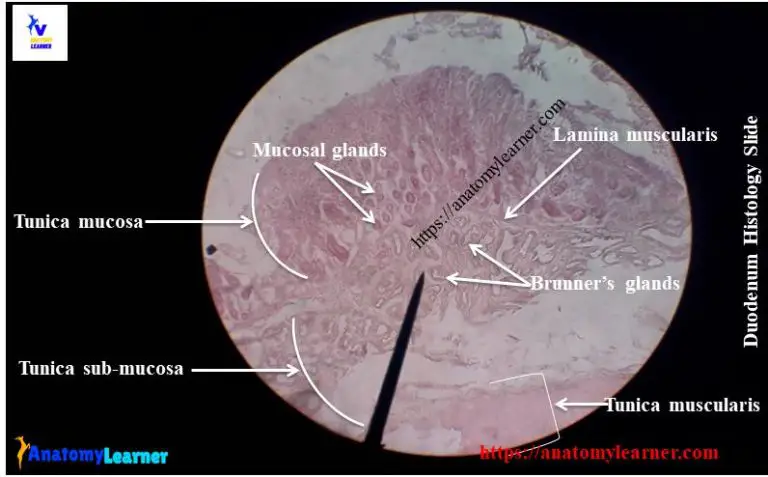 Duodenum Histology Slide with Labeled Diagram » AnatomyLearner >> The ...