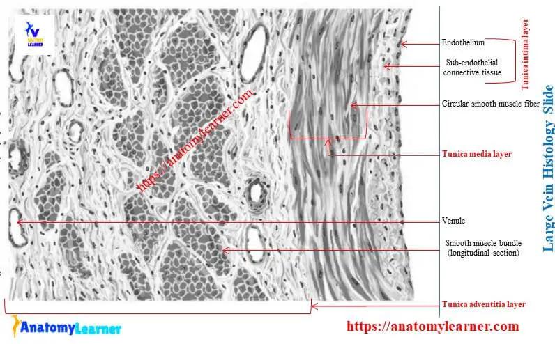 Large vein histology slide labeled