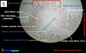 Jejunum Histology Slide with Labeled Diagram and Identification Points ...