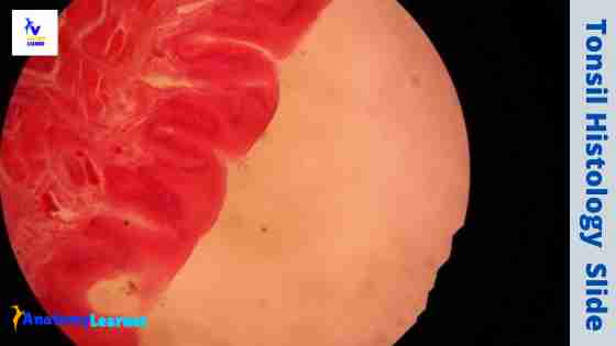 Tonsil histology slide microscope image