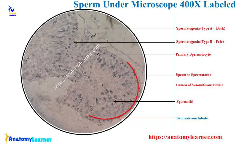 Sperm Under Microscope 400X Labeled Diagram