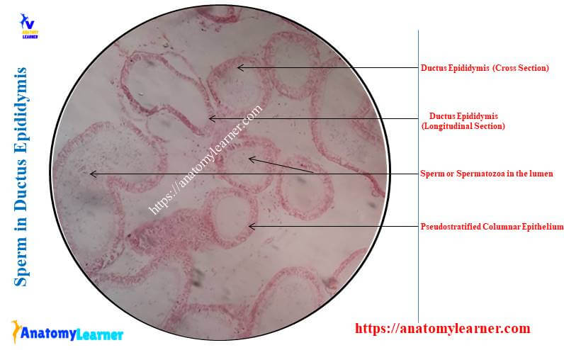 Sperm under microscope labeled (Ductus Epididymis)